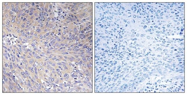 Anti-MRPL11 antibody produced in rabbit