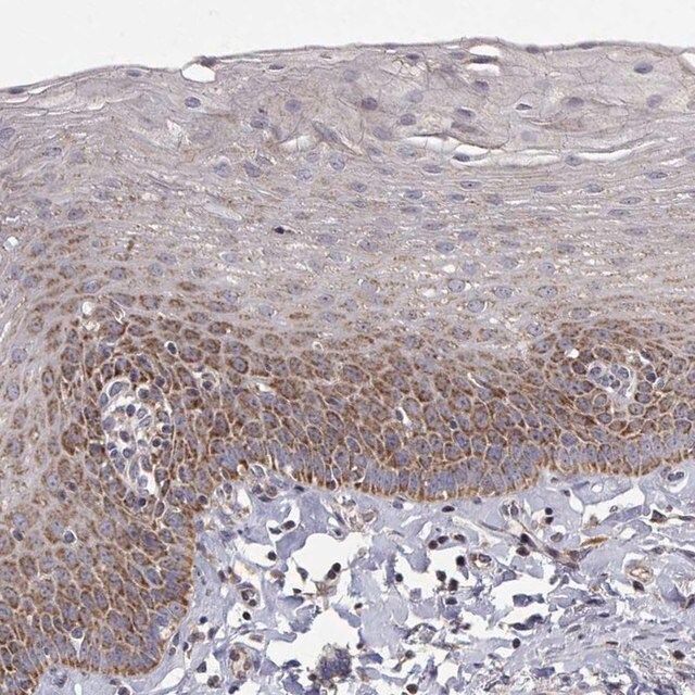 Anti-MRPL3 antibody produced in rabbit