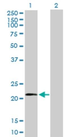 Anti-MRPL11 antibody produced in mouse