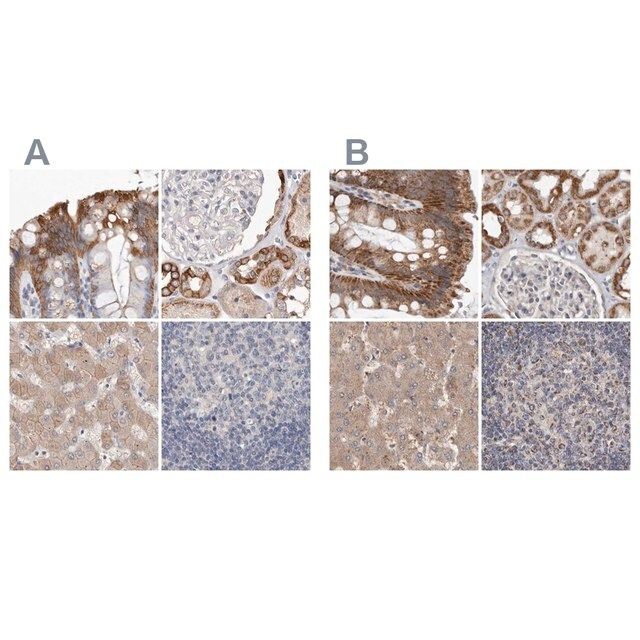 Anti-MRPL18 antibody produced in rabbit