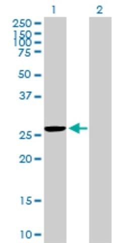 Anti-MRPS35 antibody produced in mouse