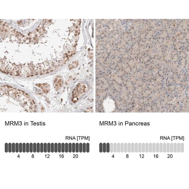 Anti-MRM3 antibody produced in rabbit