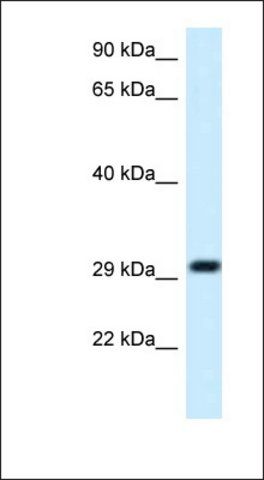 Anti-MRPL19 antibody produced in rabbit