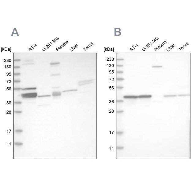 Anti-MRPL38 antibody produced in rabbit