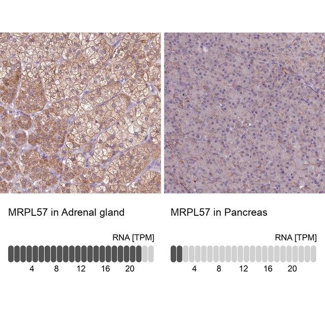 Anti-MRPL57 antibody produced in rabbit