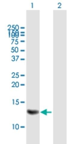 Anti-MRPS6 antibody produced in mouse