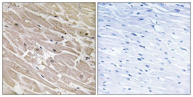 Anti-MRPL46 antibody produced in rabbit