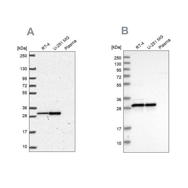 Anti-MRPL28 antibody produced in rabbit