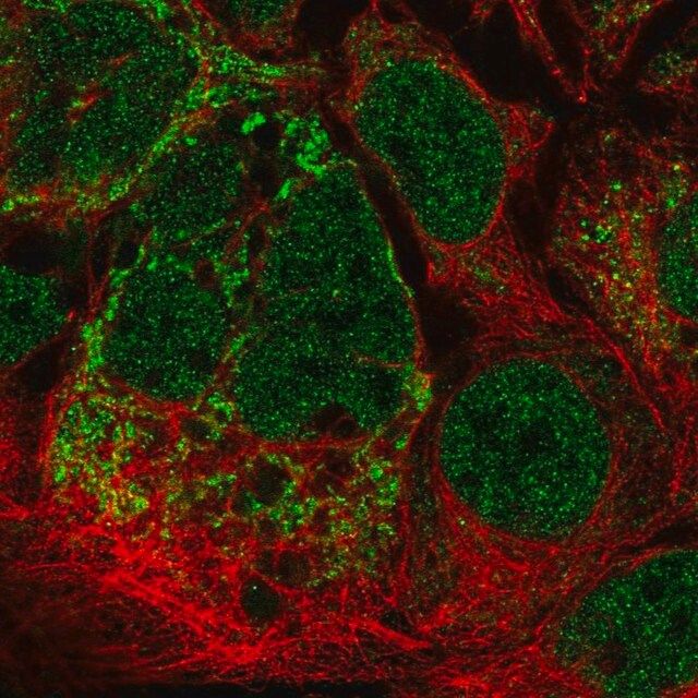 Anti-MRPL2 antibody produced in rabbit