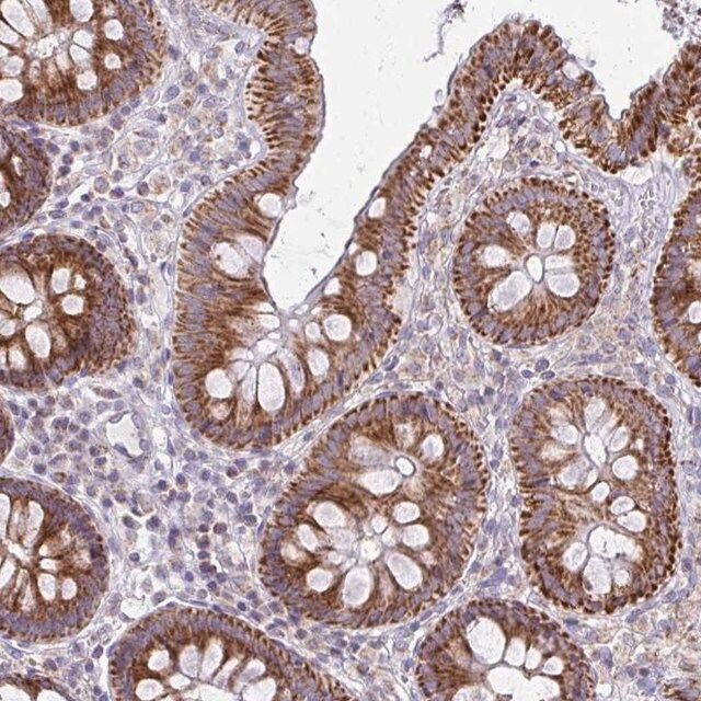 Anti-MRPL19 antibody produced in rabbit