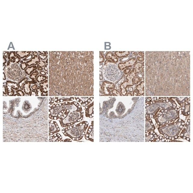 Anti-MRPL45 antibody produced in rabbit