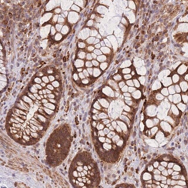 Anti-MRPL23 antibody produced in rabbit