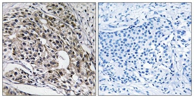 Anti-MRPL13 antibody produced in rabbit