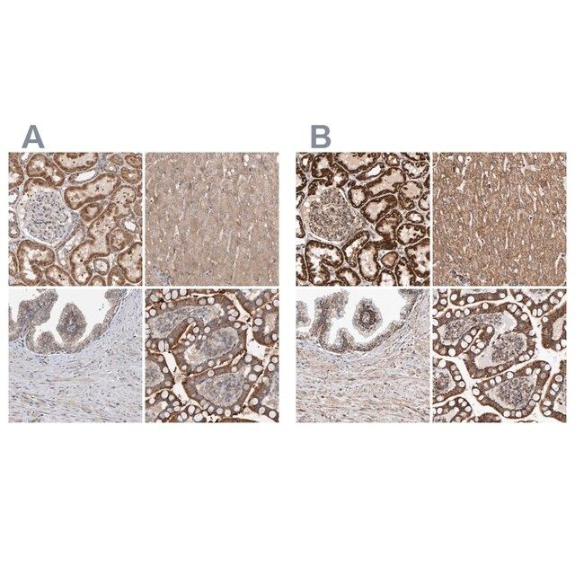 Anti-MRPL45 antibody produced in rabbit