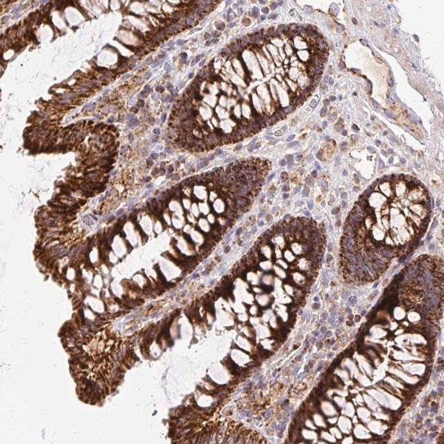 Anti-MRPL13 antibody produced in rabbit