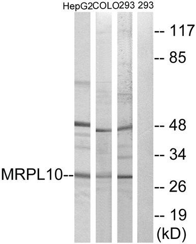 Anti-MRPL10 antibody produced in rabbit