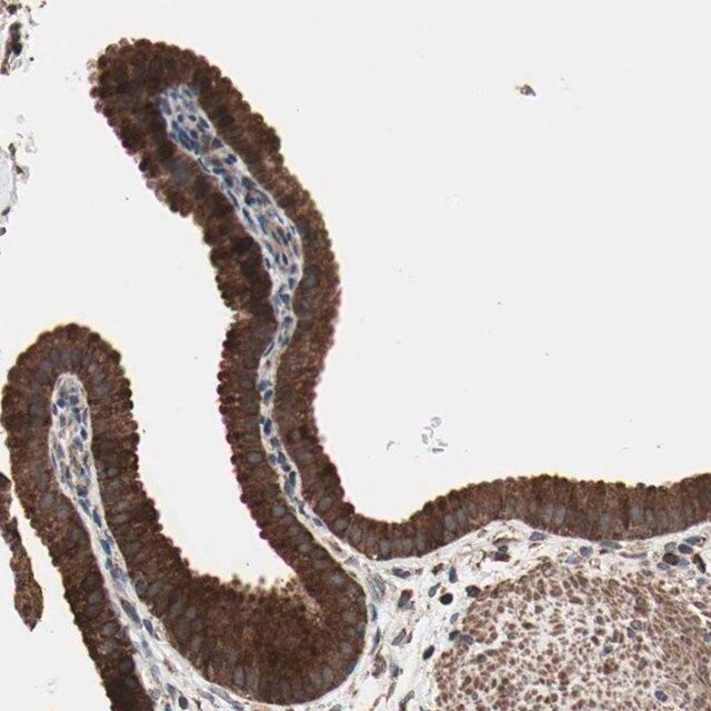 Anti-MRPL2 antibody produced in rabbit