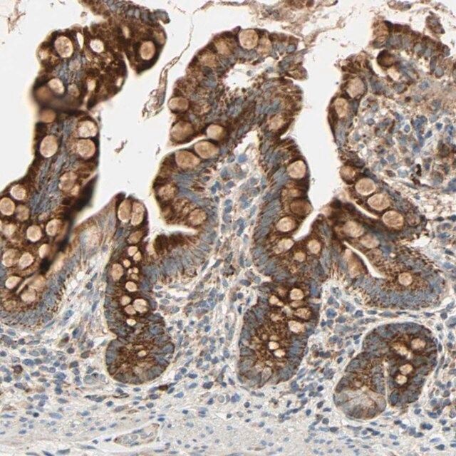 Anti-MRPL9 antibody produced in rabbit