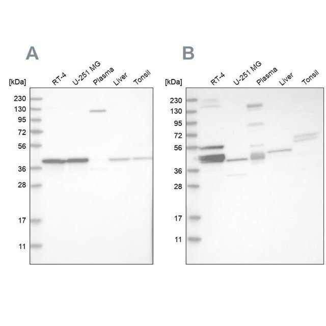 Anti-MRPL38 antibody produced in rabbit