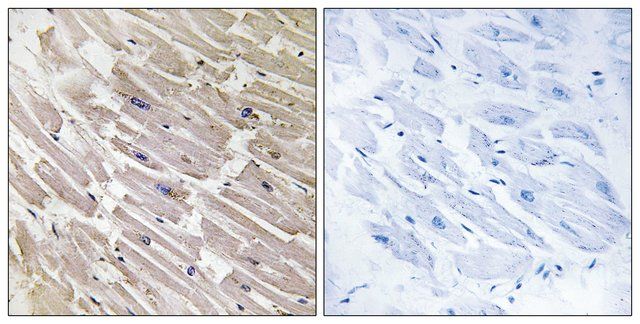 Anti-MRPL16 antibody produced in rabbit