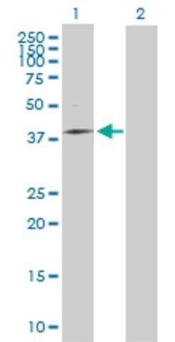 Anti-MRPS31 antibody produced in mouse