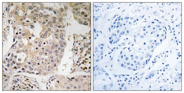 Anti-MRPL41 antibody produced in rabbit