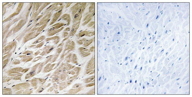 Anti-MRPS24 antibody produced in rabbit