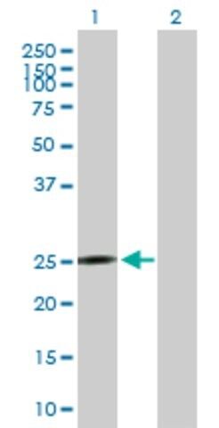 Anti-MRPS10 antibody produced in mouse