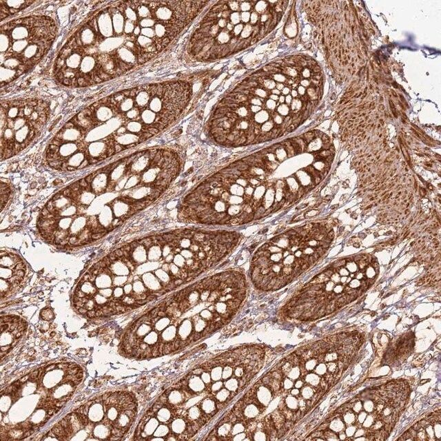 Anti-MRPS6 antibody produced in rabbit