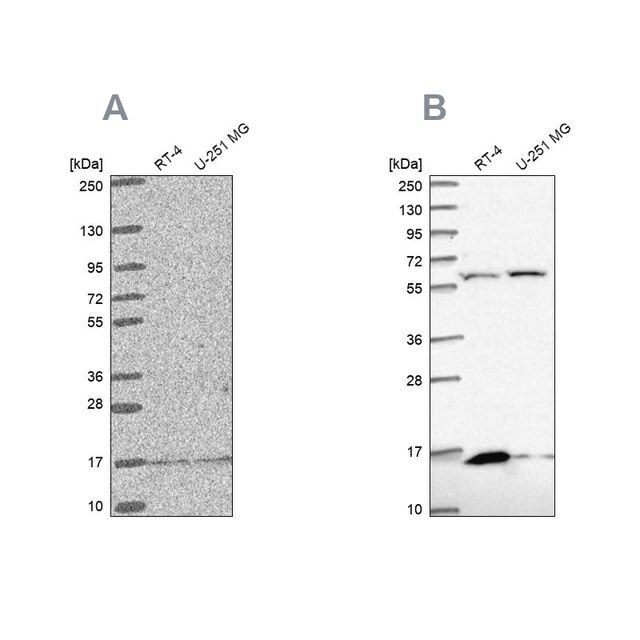 Anti-MRPS16 antibody produced in rabbit