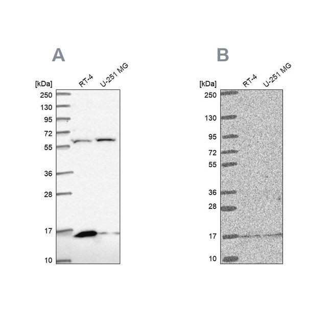 Anti-MRPS16 antibody produced in rabbit