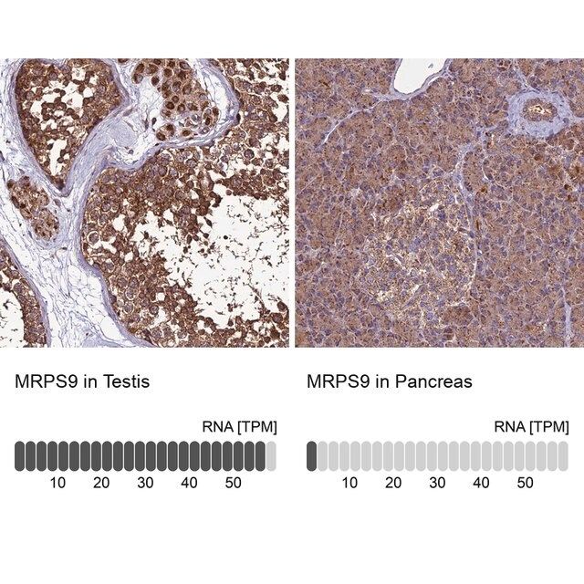 Anti-MRPS9 antibody produced in rabbit