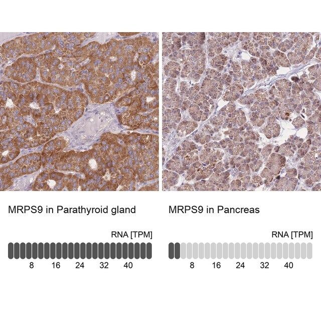 Anti-MRPS9 antibody produced in rabbit