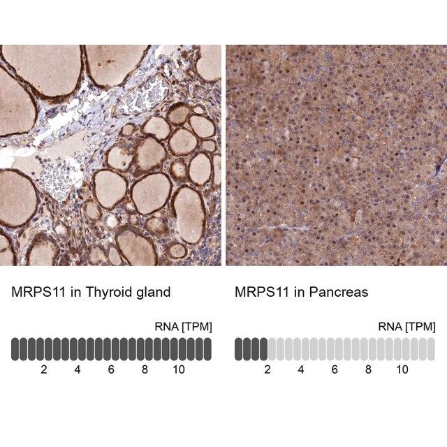 Anti-MRPS11 antibody produced in rabbit