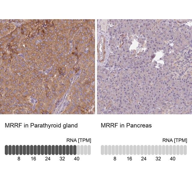 Anti-MRRF antibody produced in rabbit