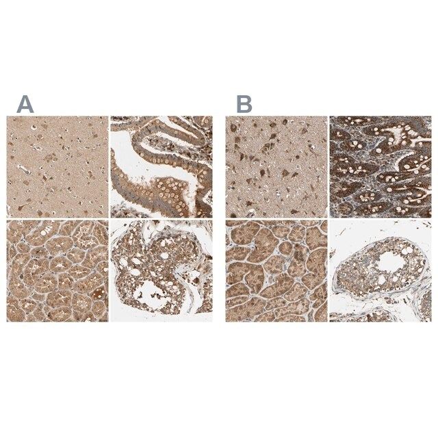 Anti-MRPS22 antibody produced in rabbit