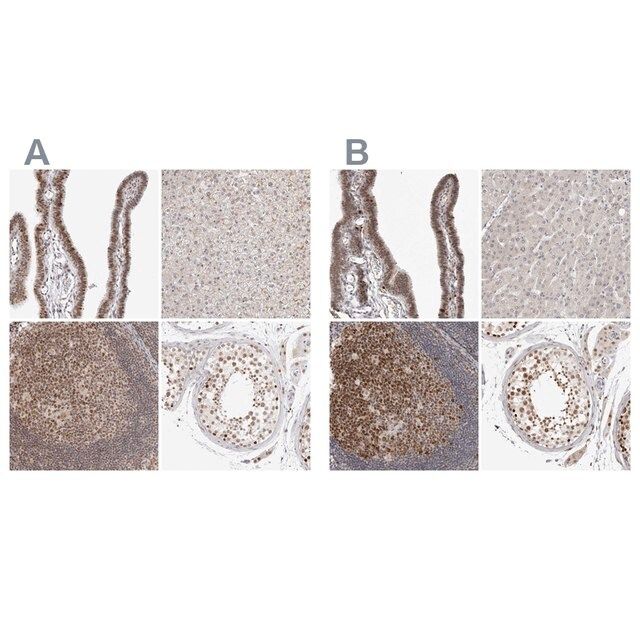 Anti-MSH6 antibody produced in rabbit