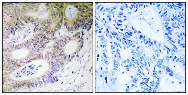 Anti-MSK1 antibody produced in rabbit