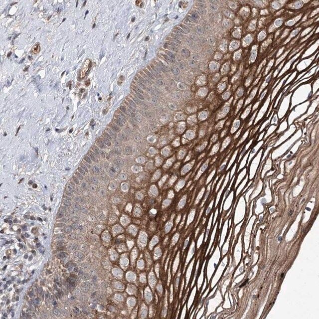 Anti-MSANTD2 antibody produced in rabbit