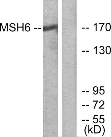 Anti-MSH6 antibody produced in rabbit