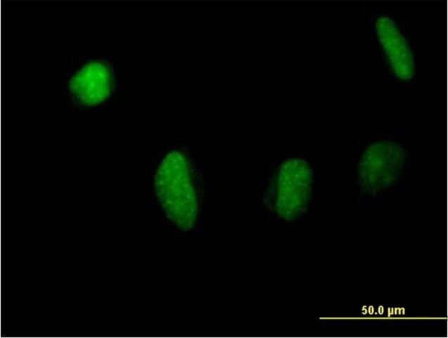 Anti-MSL3L1 antibody produced in mouse