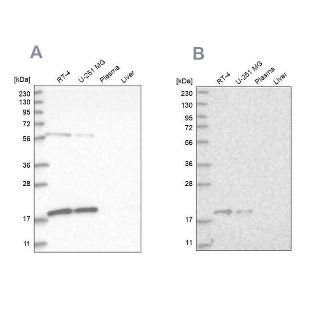 Anti-MRPS10 antibody produced in rabbit