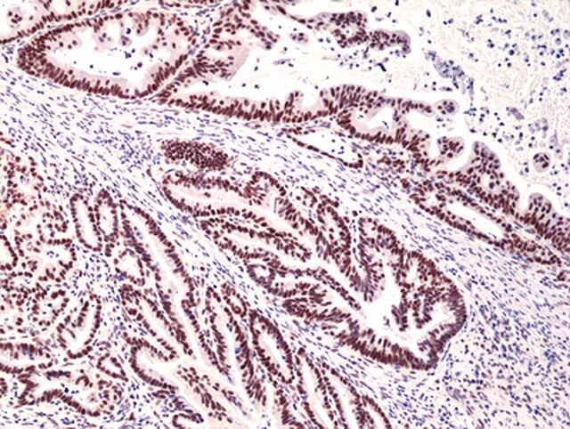 Anti-MSH3 Rabbit Monoclonal Antibody