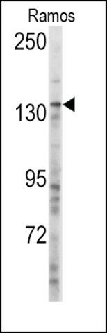 Anti-MSH3 (center) antibody produced in rabbit