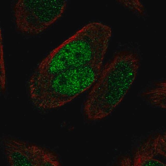 Anti-MSH2 antibody produced in rabbit