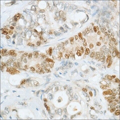 Anti-MSH6 antibody, Rabbit monoclonal