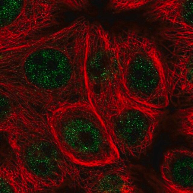 Anti-MSRB1 antibody produced in rabbit