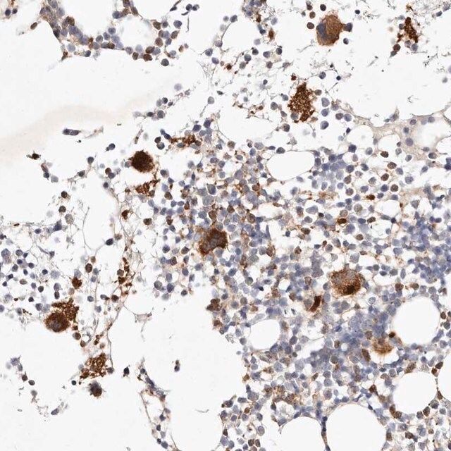 Anti-MTMR11 antibody produced in rabbit