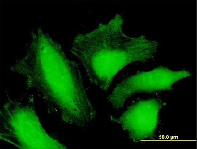 Anti-MTMR15 antibody produced in mouse