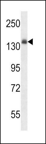 ANTI-MOUSE INSR (CENTER) antibody produced in rabbit